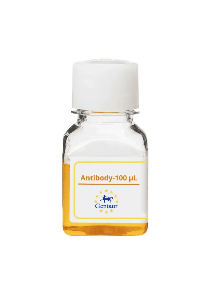 ALKBH4 Antibody  FITC conjugated   