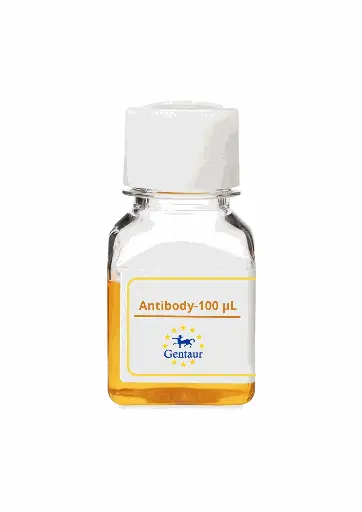 [PA019079GA01HU-100 µL] PTX3 Antibody