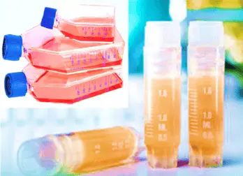 [CELL-SK-769] Human Adrenal Microvascular Endothelial Cells